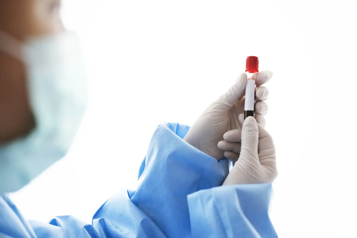 Doctor holding a blood test tube,  